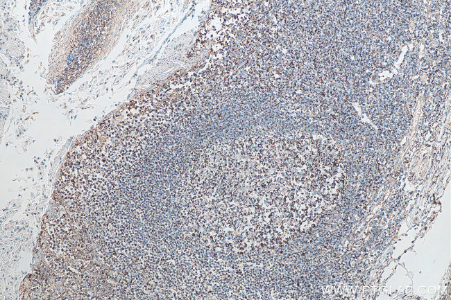 CXCR4 Antibody in Immunohistochemistry (Paraffin) (IHC (P))