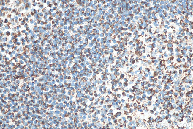 CXCR4 Antibody in Immunohistochemistry (Paraffin) (IHC (P))