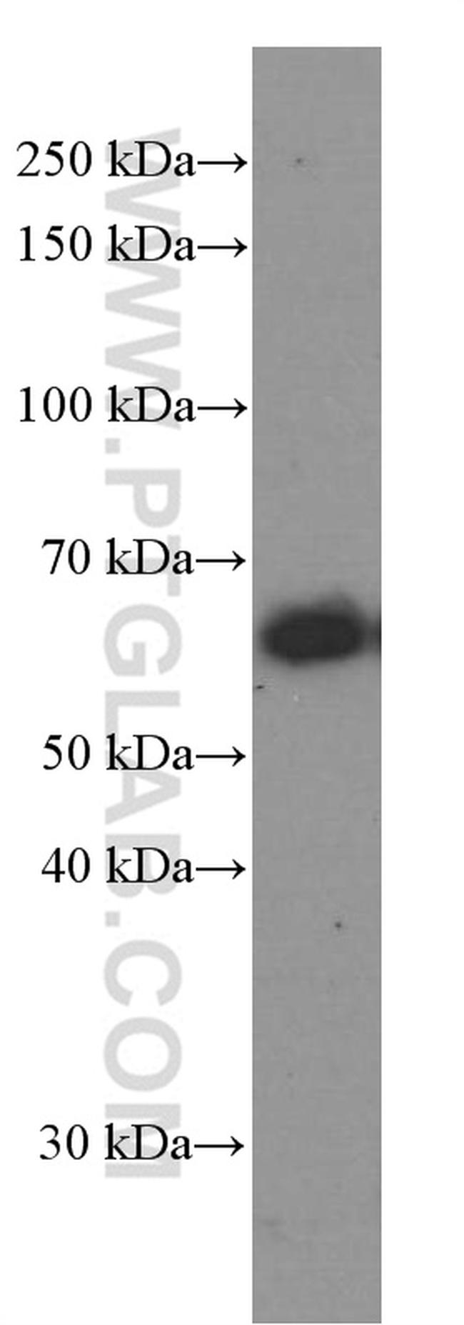 CXCR4 Antibody in Western Blot (WB)