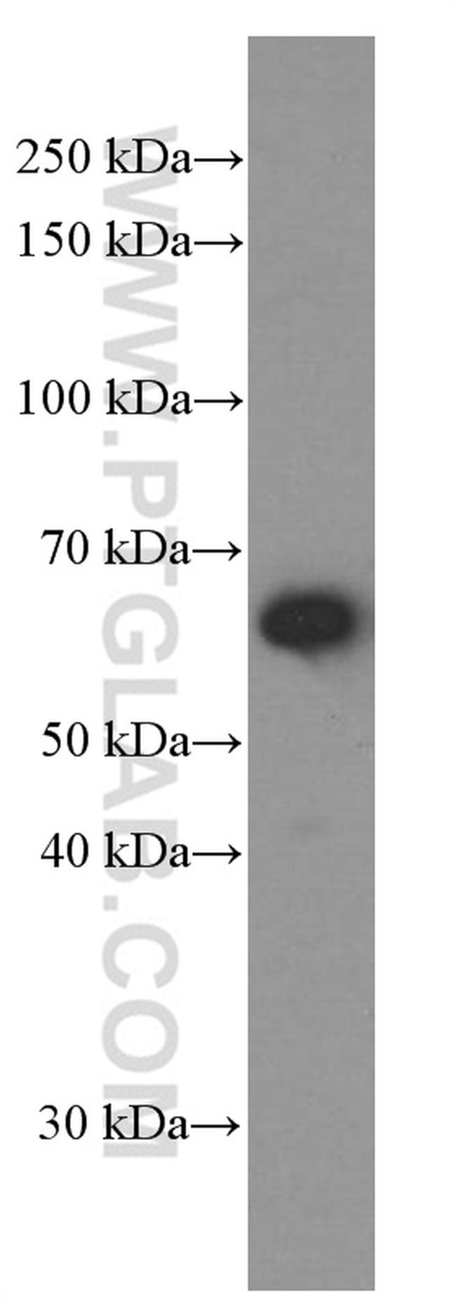 CXCR4 Antibody in Western Blot (WB)