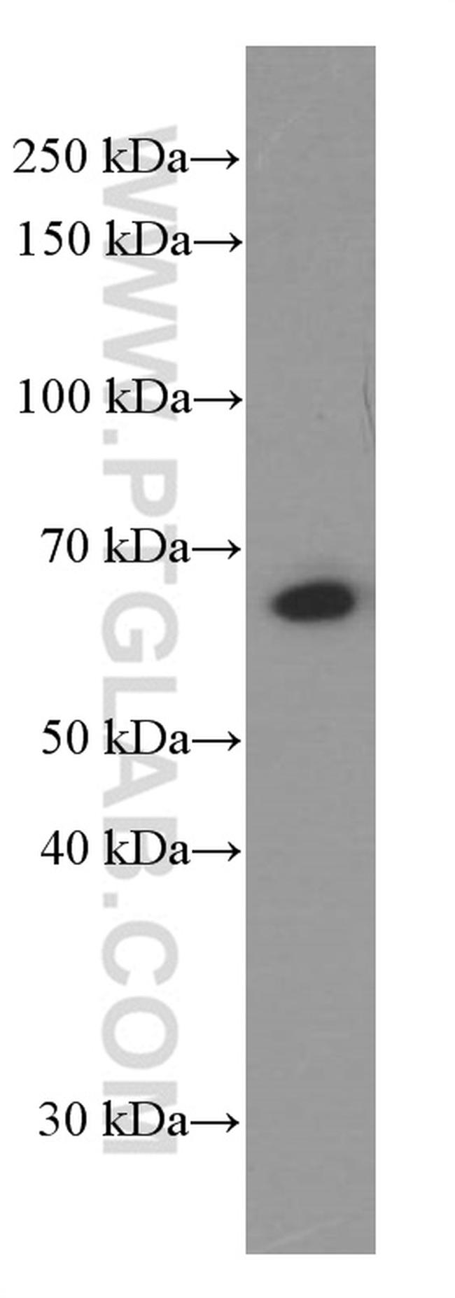 CXCR4 Antibody in Western Blot (WB)