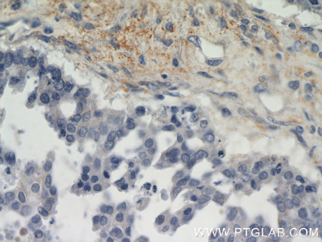 EMILIN1 Antibody in Immunohistochemistry (Paraffin) (IHC (P))