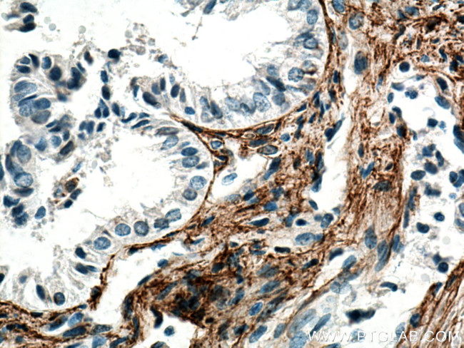 EMILIN1 Antibody in Immunohistochemistry (Paraffin) (IHC (P))