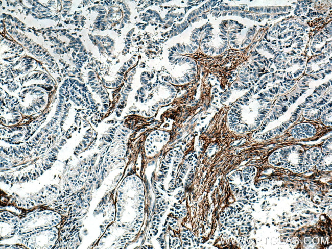 EMILIN1 Antibody in Immunohistochemistry (Paraffin) (IHC (P))