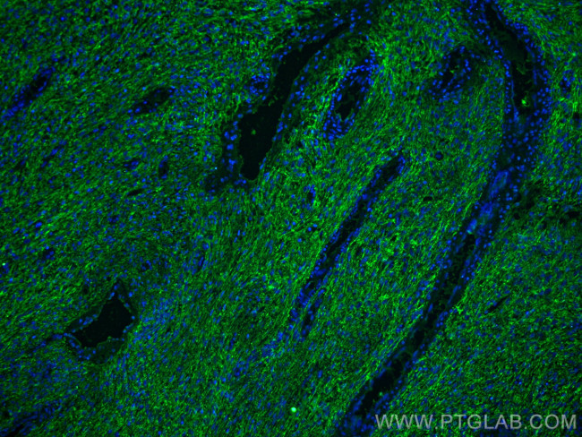 EMILIN1 Antibody in Immunohistochemistry (PFA fixed) (IHC (PFA))