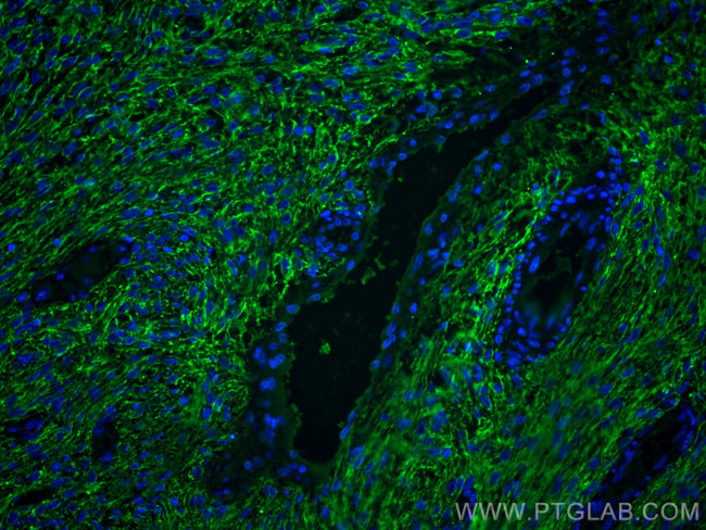 EMILIN1 Antibody in Immunohistochemistry (PFA fixed) (IHC (PFA))