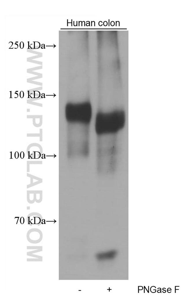 EMILIN1 Antibody in Western Blot (WB)