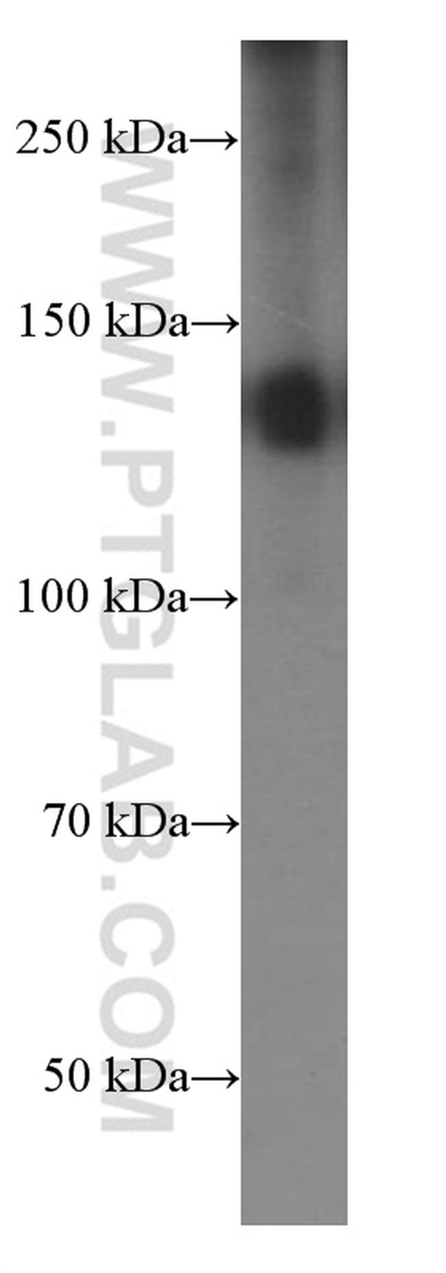 EMILIN1 Antibody in Western Blot (WB)