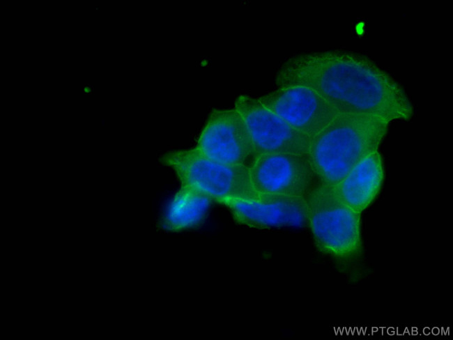 Annexin A2 Antibody in Immunocytochemistry (ICC/IF)