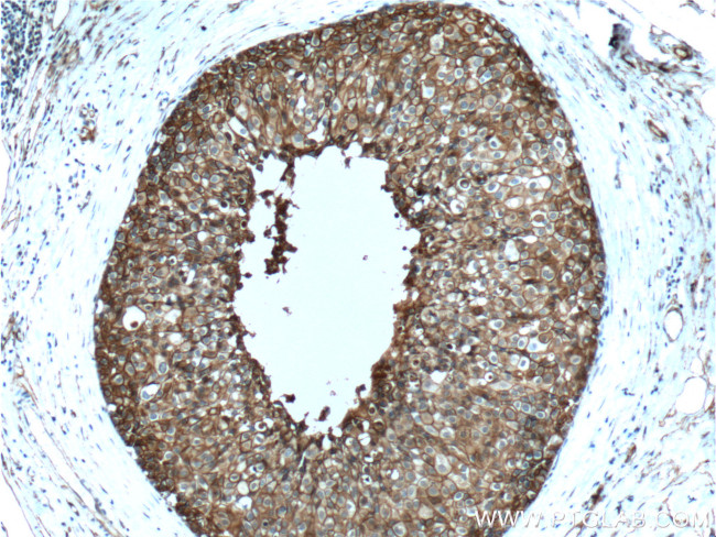 Annexin A2 Antibody in Immunohistochemistry (Paraffin) (IHC (P))