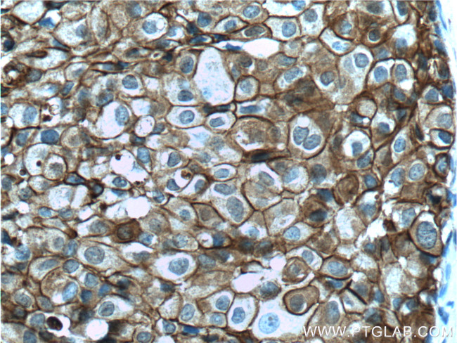 Annexin A2 Antibody in Immunohistochemistry (Paraffin) (IHC (P))