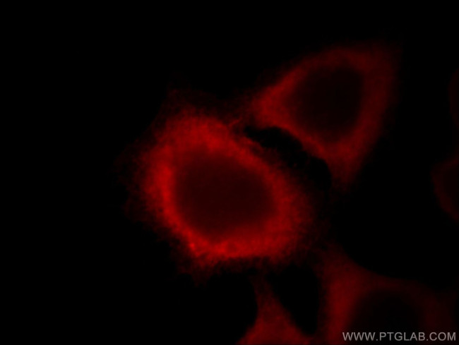 Annexin A2 Antibody in Immunocytochemistry (ICC/IF)