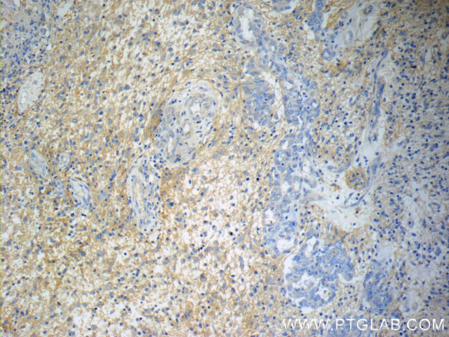 Annexin A2 Antibody in Immunohistochemistry (Paraffin) (IHC (P))