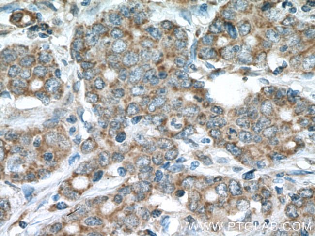 STOML2 Antibody in Immunohistochemistry (Paraffin) (IHC (P))