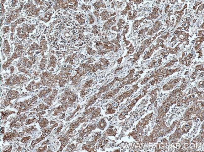 STOML2 Antibody in Immunohistochemistry (Paraffin) (IHC (P))