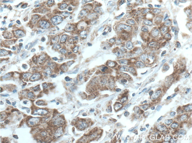 STOML2 Antibody in Immunohistochemistry (Paraffin) (IHC (P))