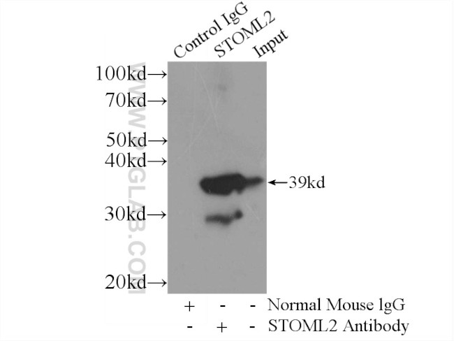 STOML2 Antibody in Immunoprecipitation (IP)