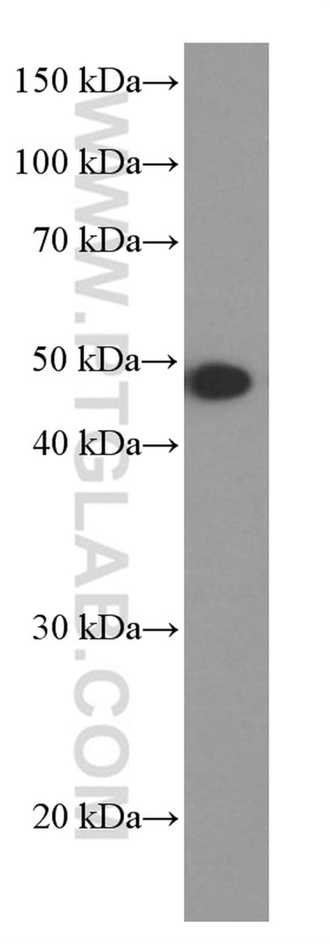 MAGEA3 Antibody in Western Blot (WB)