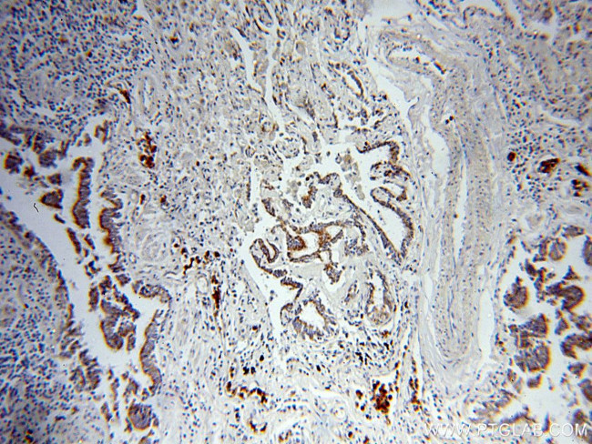 MAGEA3 Antibody in Immunohistochemistry (Paraffin) (IHC (P))