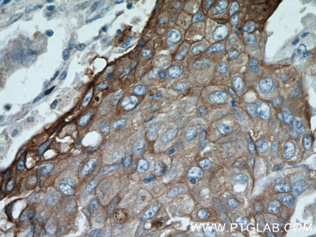 MAGEA3 Antibody in Immunohistochemistry (Paraffin) (IHC (P))