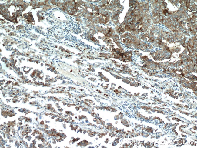 MAGEA3 Antibody in Immunohistochemistry (Paraffin) (IHC (P))