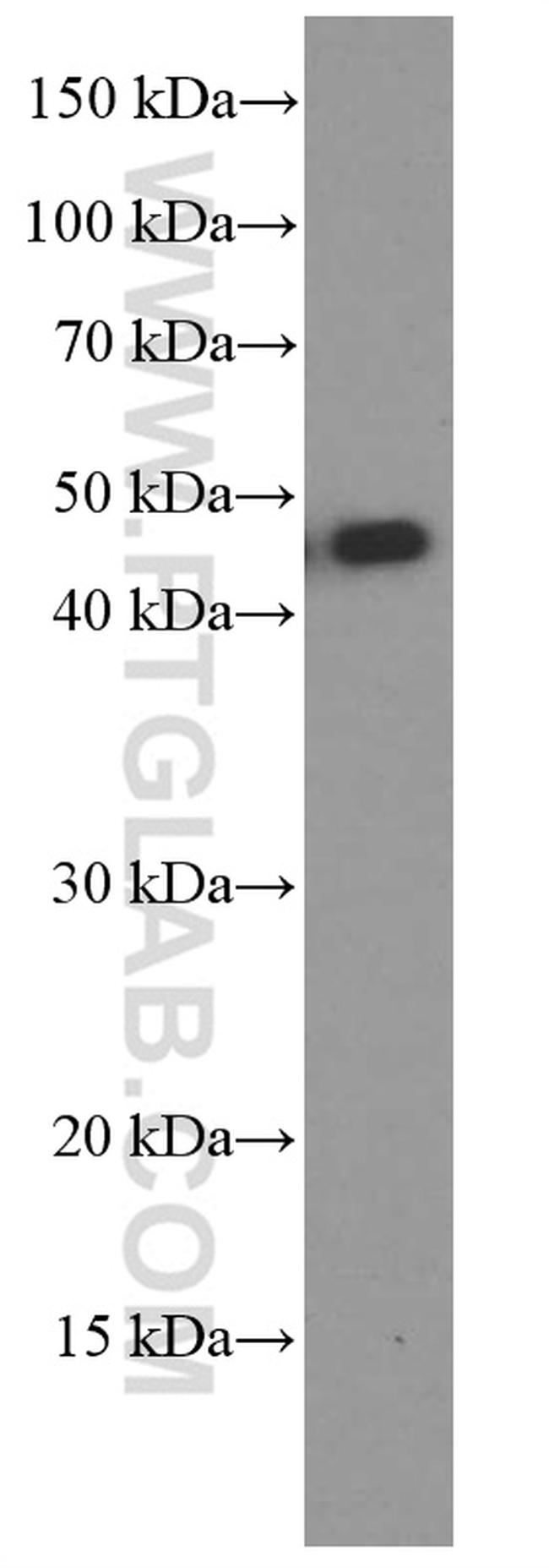 MAGEA3 Antibody in Western Blot (WB)