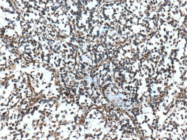 MGP Antibody in Immunohistochemistry (Paraffin) (IHC (P))