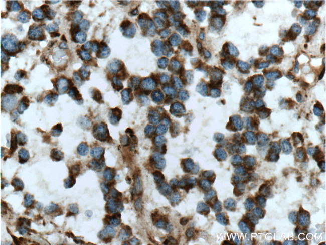 MGP Antibody in Immunohistochemistry (Paraffin) (IHC (P))