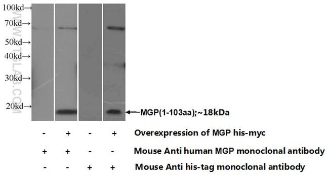 MGP Antibody in Western Blot (WB)