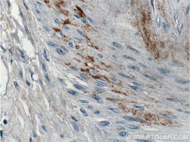 MGP Antibody in Immunohistochemistry (Paraffin) (IHC (P))