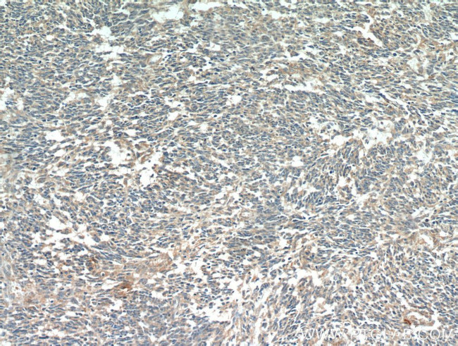 MGP Antibody in Immunohistochemistry (Paraffin) (IHC (P))