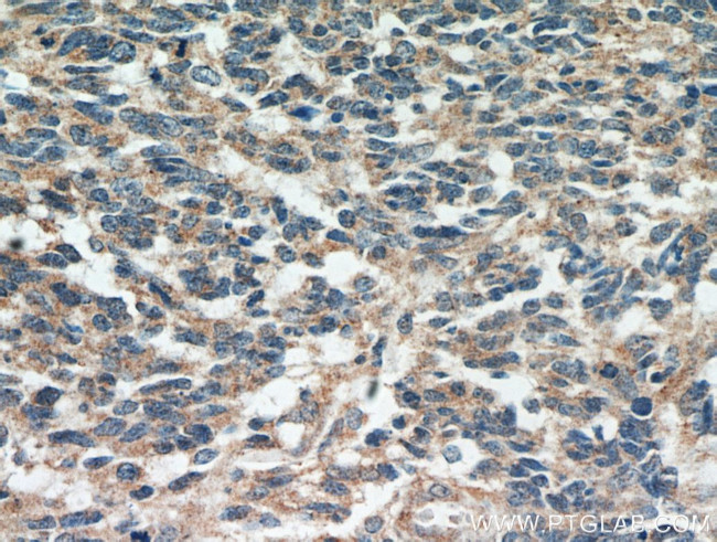 MGP Antibody in Immunohistochemistry (Paraffin) (IHC (P))