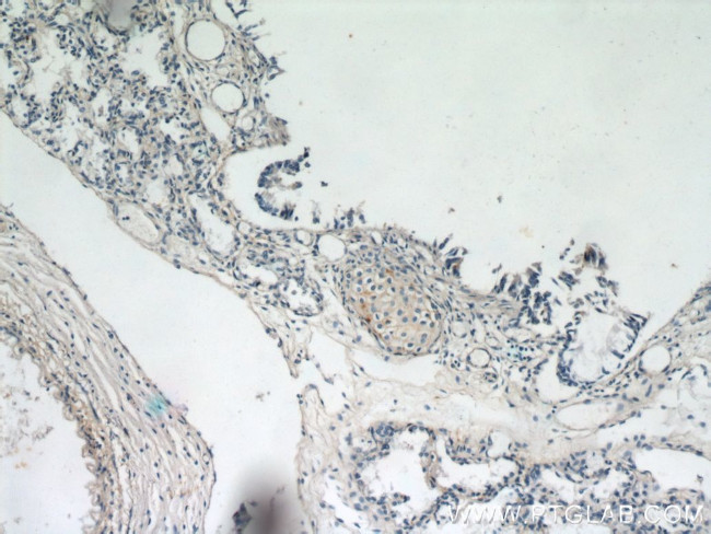 MGP Antibody in Immunohistochemistry (Paraffin) (IHC (P))