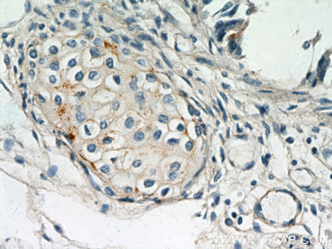 MGP Antibody in Immunohistochemistry (Paraffin) (IHC (P))