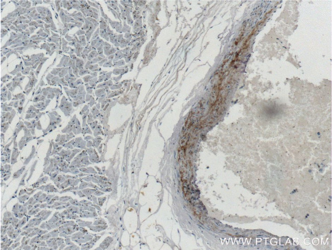 MGP Antibody in Immunohistochemistry (Paraffin) (IHC (P))