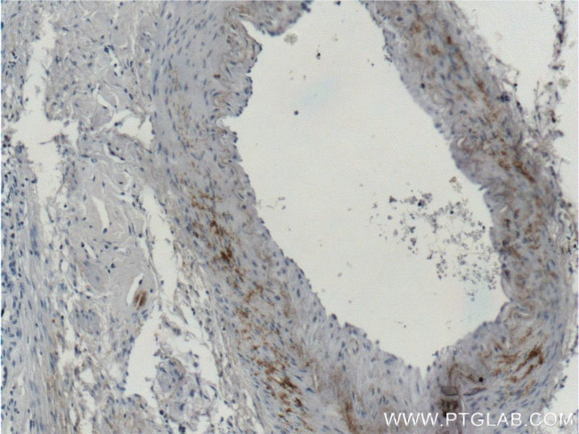 MGP Antibody in Immunohistochemistry (Paraffin) (IHC (P))