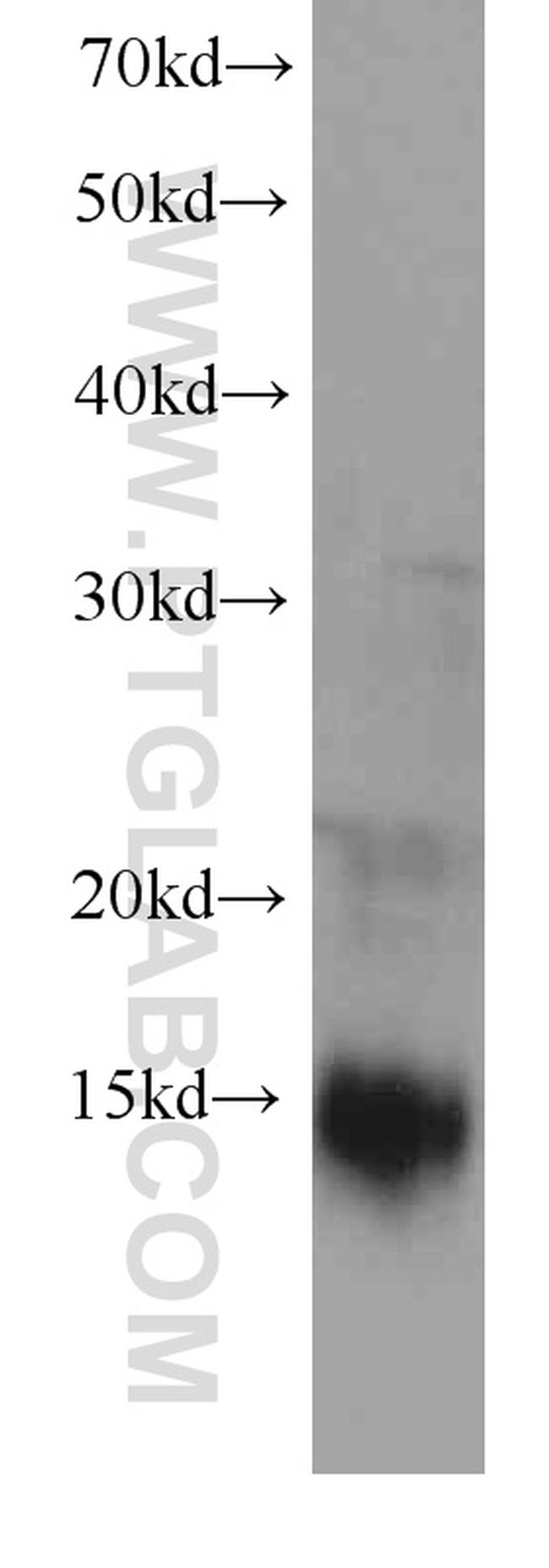 MGP Antibody in Western Blot (WB)