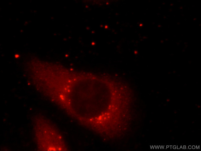 PLOD3 Antibody in Immunocytochemistry (ICC/IF)