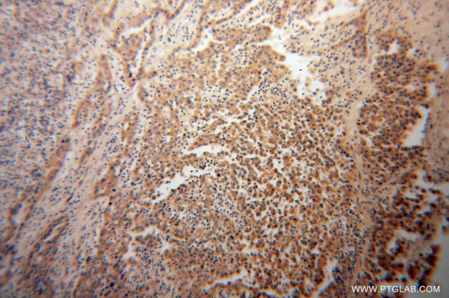 PLOD3 Antibody in Immunohistochemistry (Paraffin) (IHC (P))