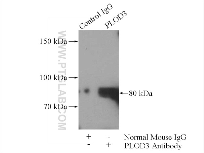 PLOD3 Antibody in Immunoprecipitation (IP)