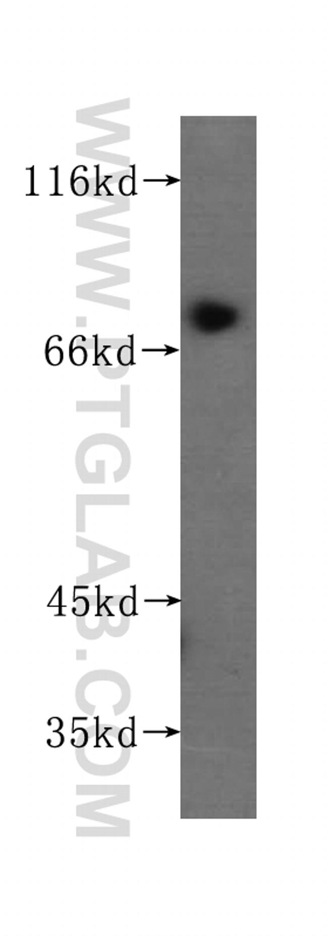 PLOD3 Antibody in Western Blot (WB)