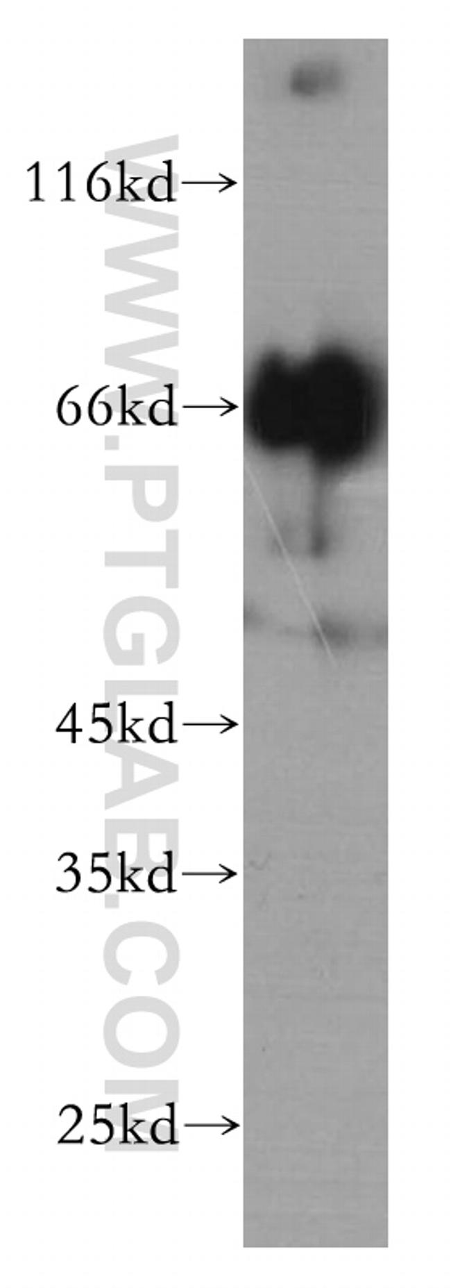 PLOD3 Antibody in Western Blot (WB)