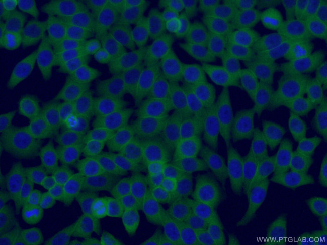 Follistatin Antibody in Immunocytochemistry (ICC/IF)