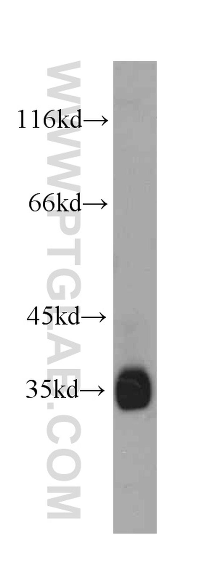 Follistatin Antibody in Western Blot (WB)