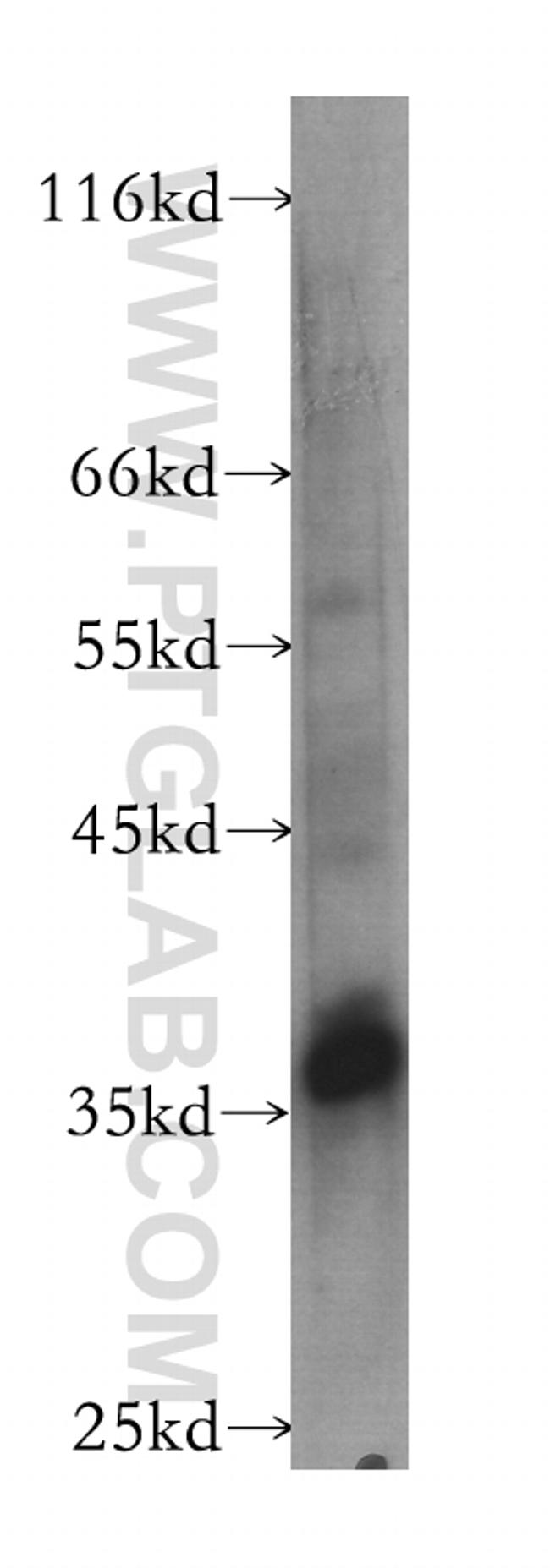 Follistatin Antibody in Western Blot (WB)