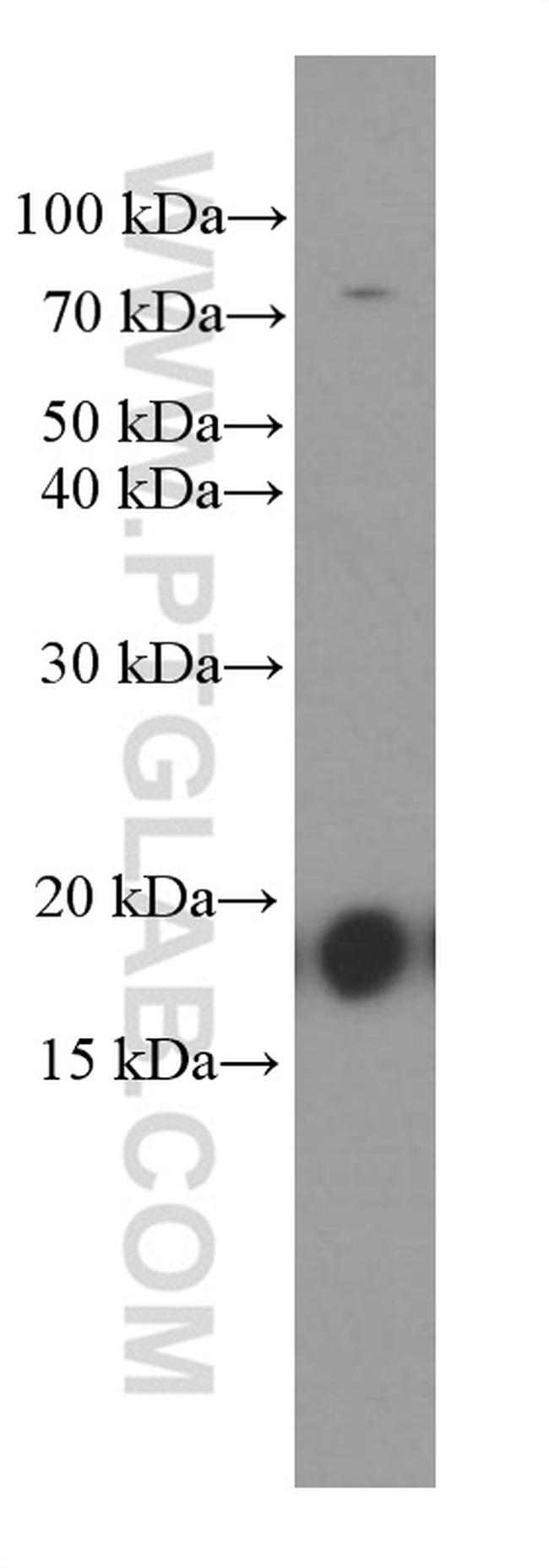 GMF-beta Antibody in Western Blot (WB)
