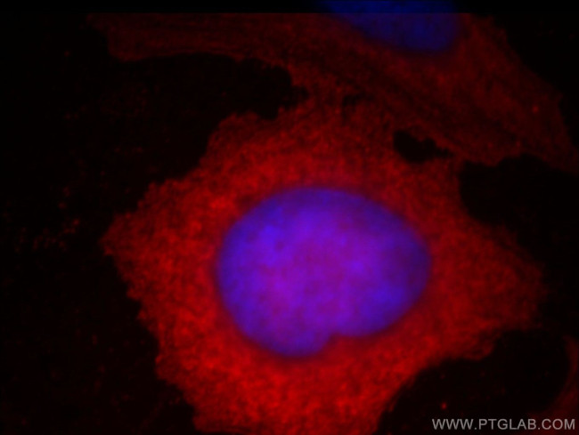 Stanniocalcin 2 Antibody in Immunocytochemistry (ICC/IF)