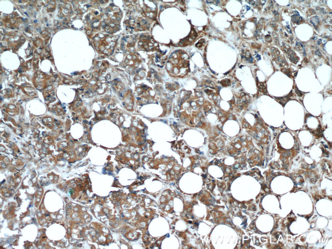 Stanniocalcin 2 Antibody in Immunohistochemistry (Paraffin) (IHC (P))