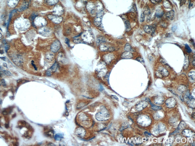 Stanniocalcin 2 Antibody in Immunohistochemistry (Paraffin) (IHC (P))