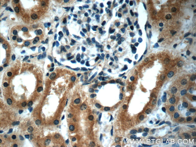 Stanniocalcin 2 Antibody in Immunohistochemistry (Paraffin) (IHC (P))